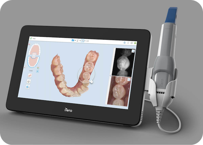 The Dental Technology That’s Changing Smiles in Rocklin