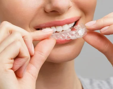 Patient placing Invisalign clear aligners at Sun Park Dental in Rocklin CA