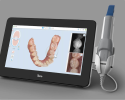 The Dental Technology That’s Changing Smiles in Rocklin